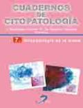 /libros/santamaria-martinez-mercedes-citopatologia-de-la-mama-cuadernos-de-citopatologia-no-7-L03009630101.html